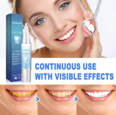 Teeth Repair Gel My Store