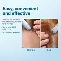 Hair Ball Essence Rosemary Growth Oil My Store