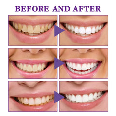 V34 Tooth Cleaning Mousse My Store