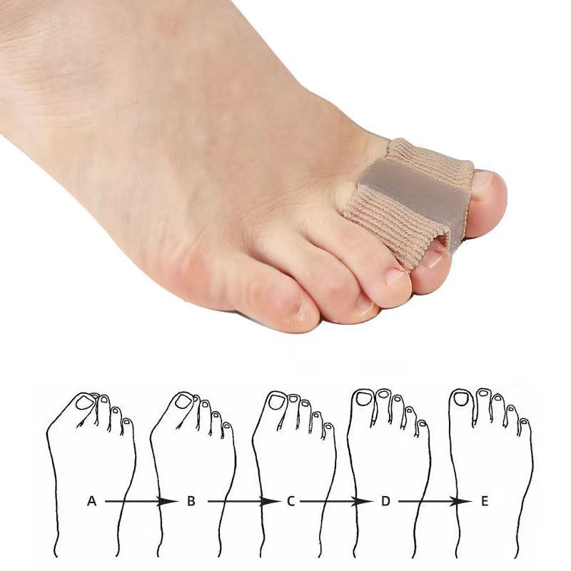 Fiber Toe Separator My Store