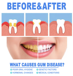 Teeth Repair Gel My Store