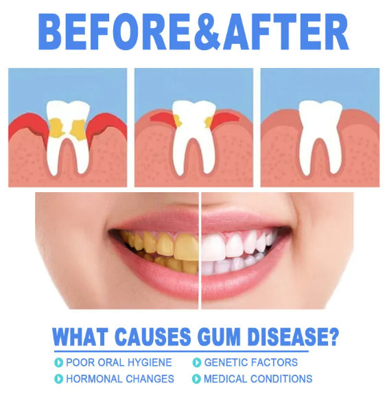 Teeth Repair Gel My Store