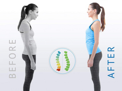 Posture Corrector Epictop store